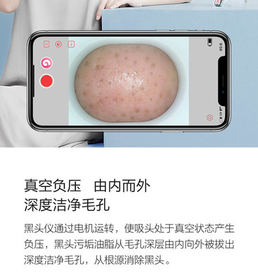 小米有品媄拾智能可視吸黑頭儀 告別黑頭，開啟“眼見為實(shí)”的清潔新時(shí)代